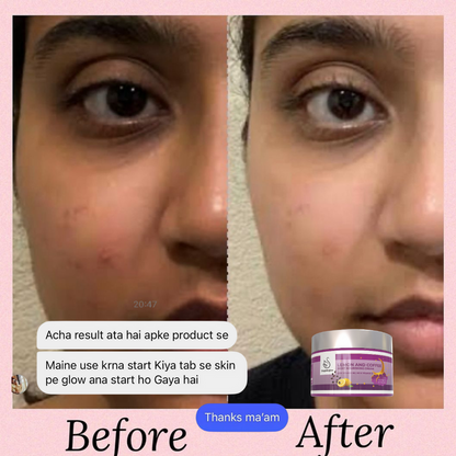 Day and Night Glow Cream Combo pack of 2